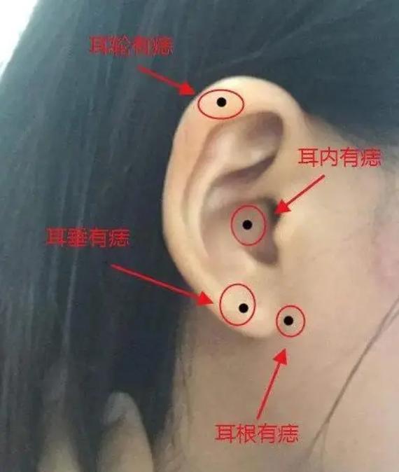 耳垂上长痣好看吗女人面相 女生耳垂下长痣好吗