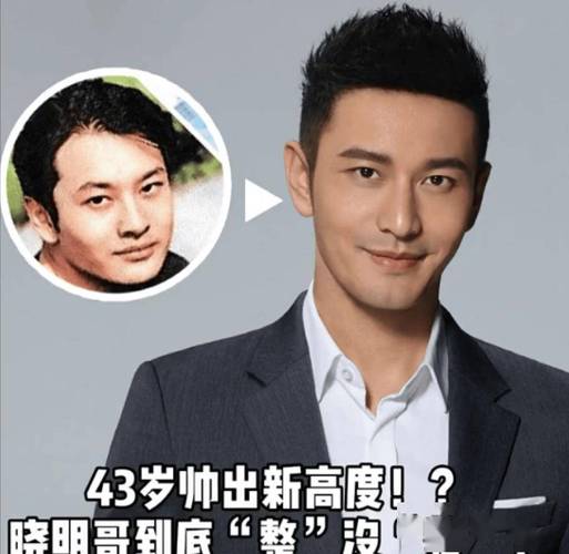 整容能整出好面相吗男人 整容男眼袋