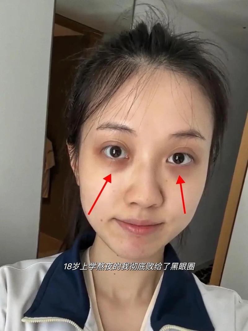 什么是黑眼圈面相女生 黑眼圈严重的女人的面相