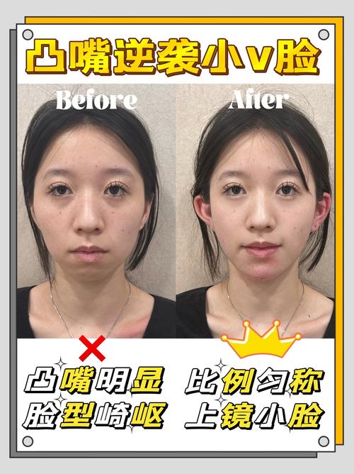 嘴能整容变宽吗女生面相 面相都是假的整容才是真的